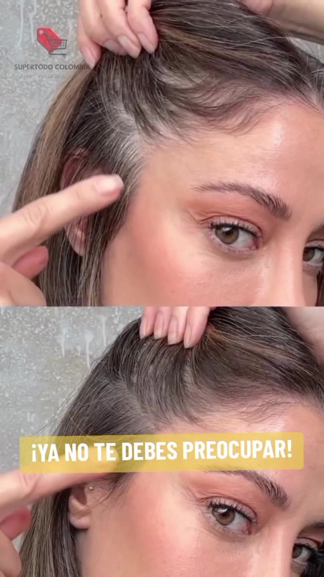 Antes y después real: raíz con canas vs. raíz cubierta con Bunee